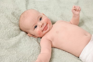 Photo of Cute little baby with allergic redness on cheeks lying on light green blanket