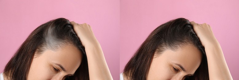 Image of Woman before and after hair treatment with high frequency darsonval device on pink background, closeup. Collage of photos
