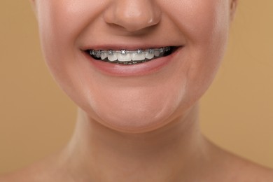Photo of Smiling woman with dental braces on brown background, closeup