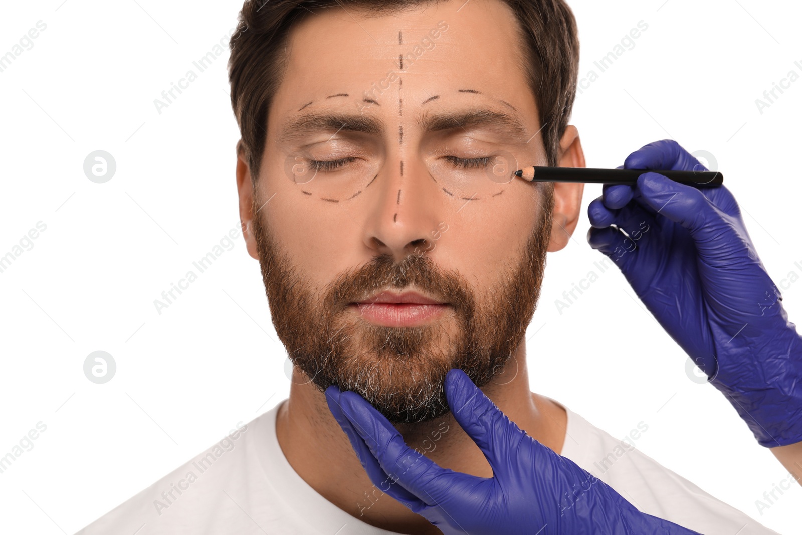 Photo of Doctor with pencil preparing patient for cosmetic surgery operation on white background, closeup