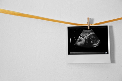 Photo of Ultrasound photo hanging on ribbon against white background, space for text