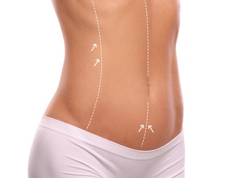 Image of Woman with markings for cosmetic surgery on her abdomen against white background, closeup