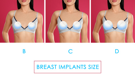 Collage with photos of woman demonstrating different implant sizes for breast on color background, closeup. Banner design 