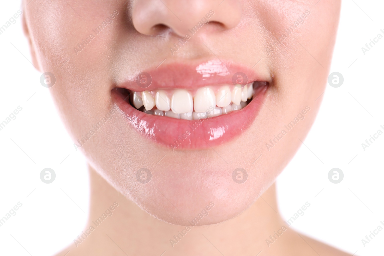 Photo of Young woman with healthy teeth smiling on white background, closeup