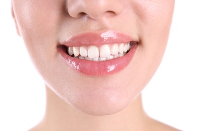 Photo of Young woman with healthy teeth smiling on white background, closeup