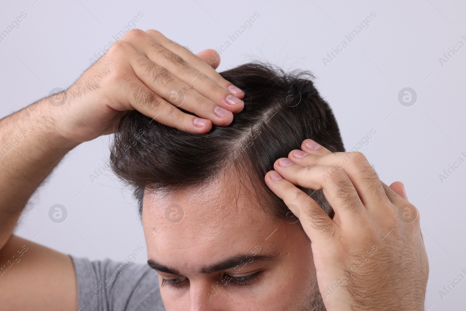 Photo of Man examining his head on light grey background, closeup. Dandruff problem