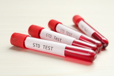 Photo of Tubes with blood samples and labels STD Test on white wooden table