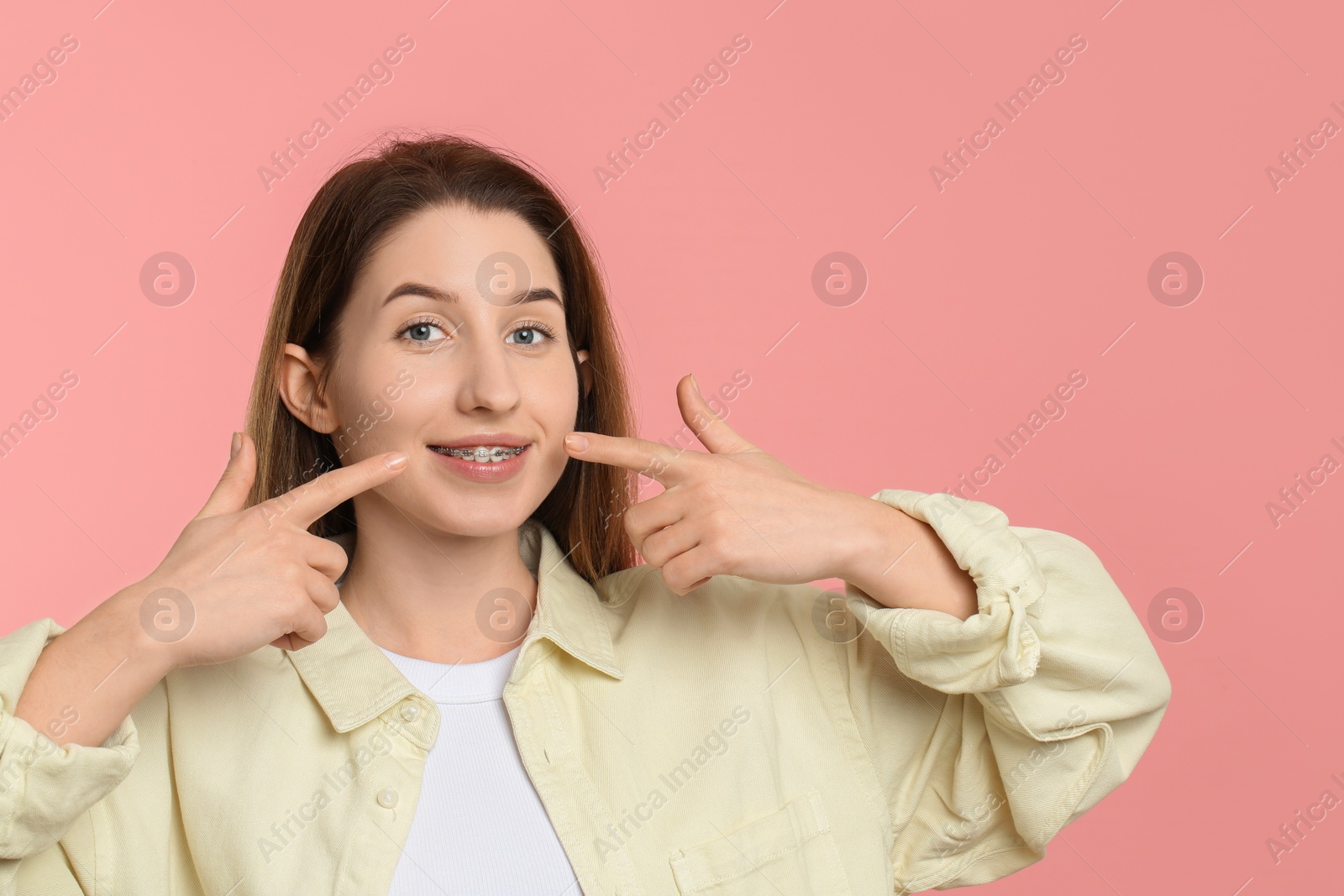 Photo of Portrait of smiling woman pointing at her dental braces on pink background