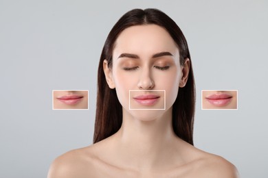 Attractive woman with beautiful lips on grey background. Zoomed areas showing difference in lip fullness due to cosmetic procedure