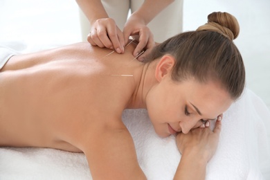 Young woman undergoing acupuncture treatment in salon