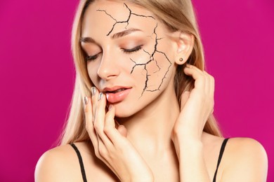 Image of Beautiful young woman with dry skin on pink background