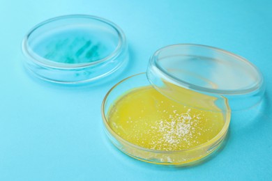 Photo of Petri dishes with different bacteria colonies on light blue background, closeup