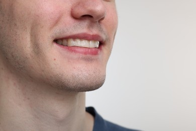 Photo of Young man using whitening strip on light background, closeup. Space for text