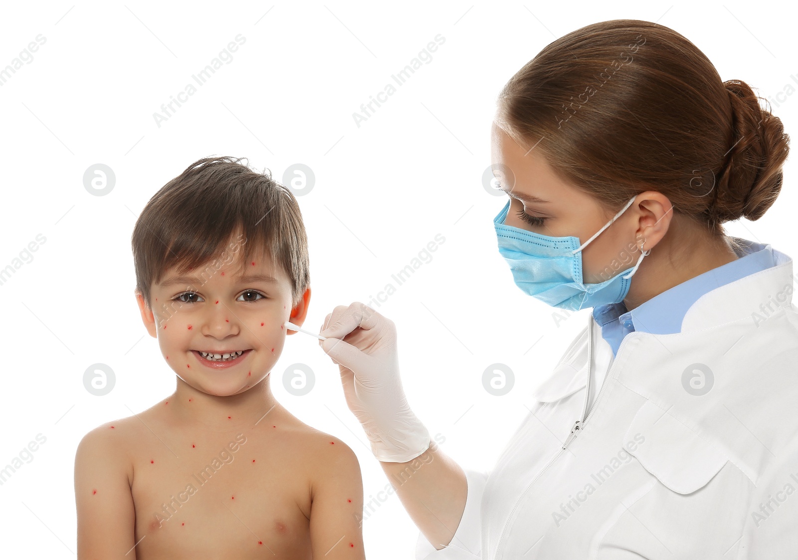 Photo of Doctor applying cream onto skin of little boy with chickenpox against white background. Varicella zoster virus