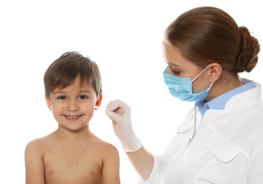 Doctor applying cream onto skin of little boy with chickenpox against white background. Varicella zoster virus