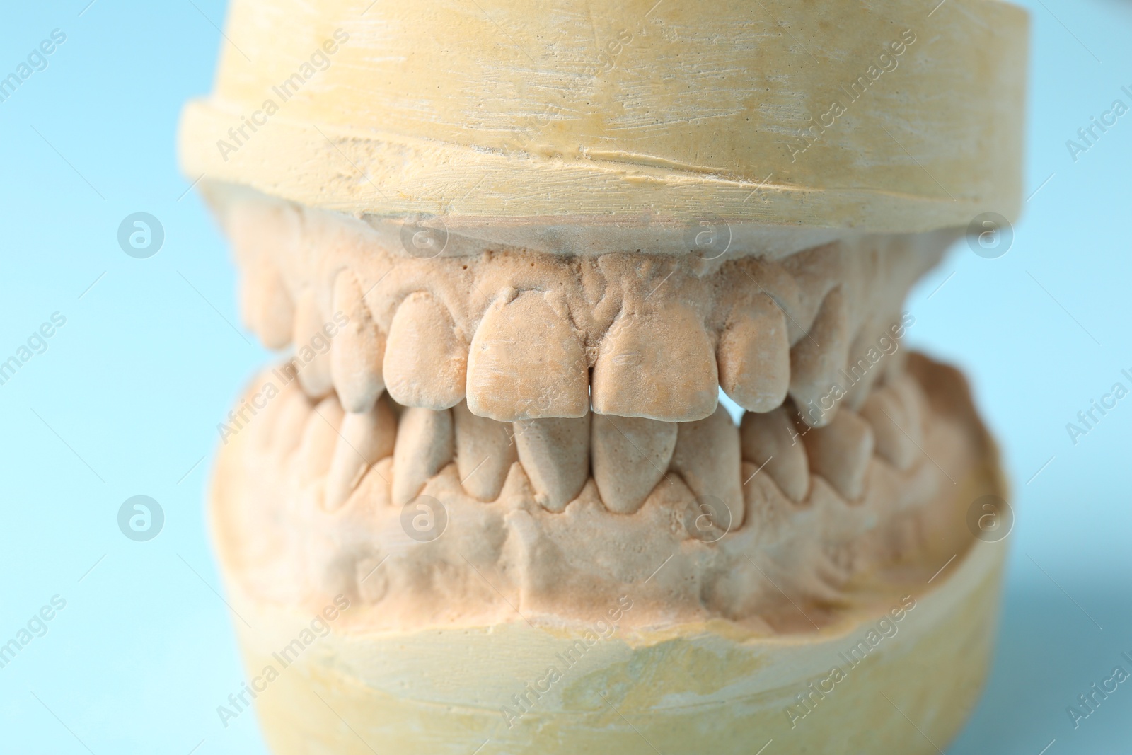 Photo of Dental model with gums on light blue background, closeup. Cast of teeth