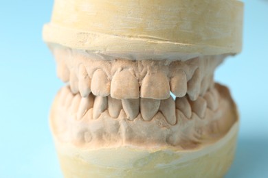 Photo of Dental model with gums on light blue background, closeup. Cast of teeth