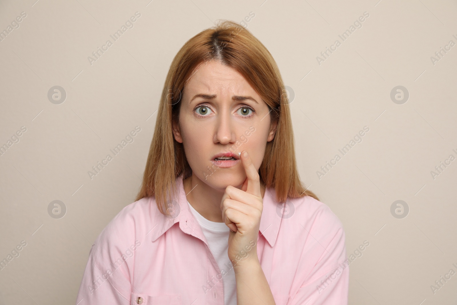 Photo of Upset woman with herpes applying cream on lips against beige background