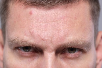 Closeup view of man with wrinkles on his forehead