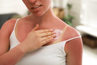Photo of Woman applying cream on sunburn at home, closeup