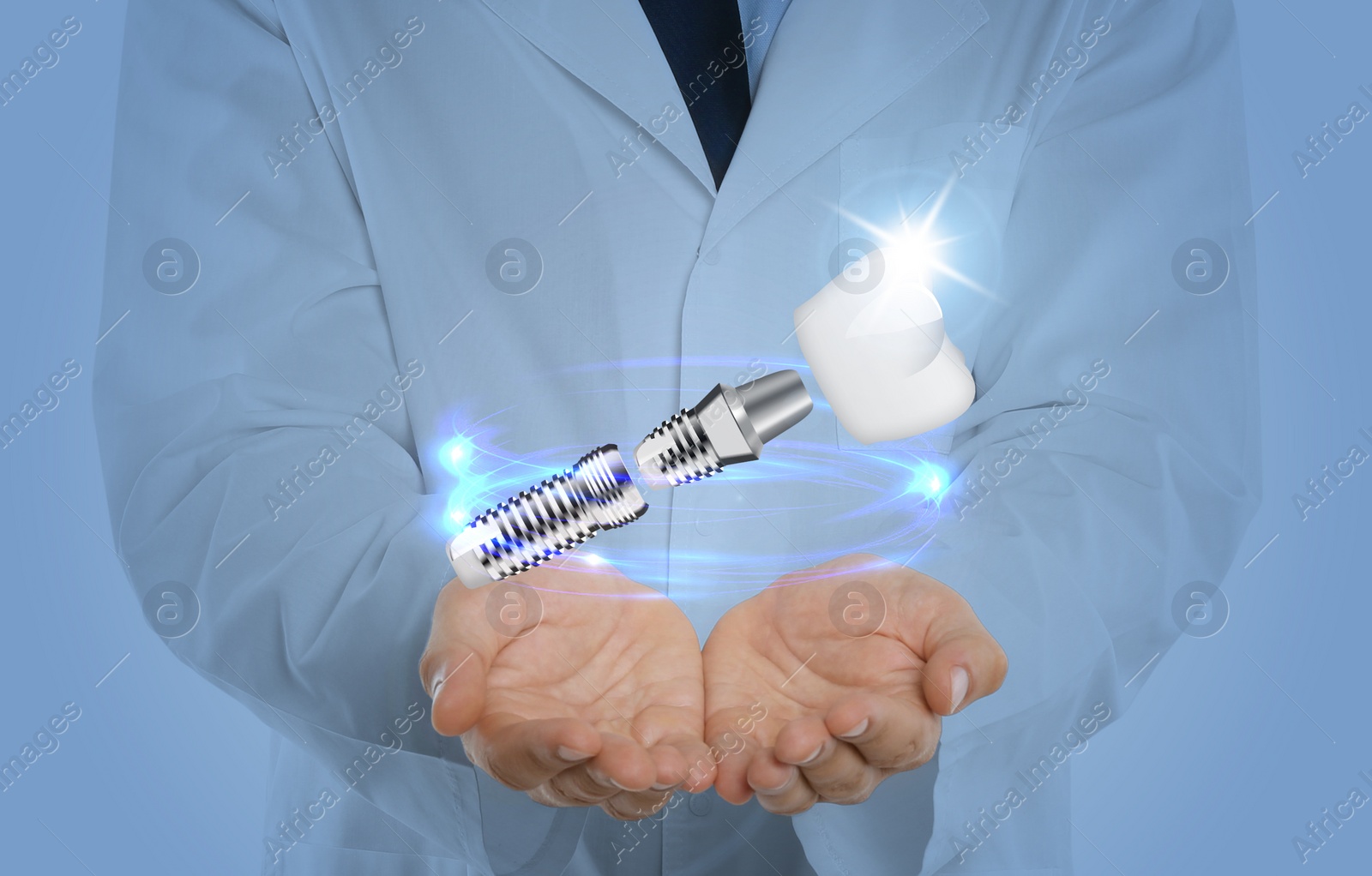 Image of Doctor demonstrating dental implant on light background, closeup