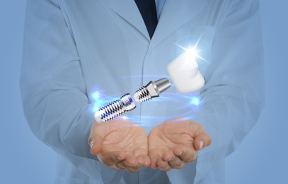 Doctor demonstrating dental implant on light background, closeup