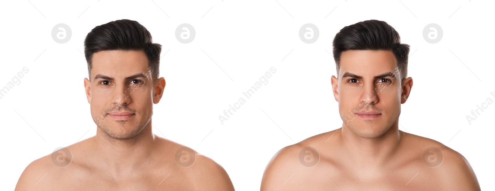 Image of Collage with photos of handsome man before and after shaving on white background. Banner design 