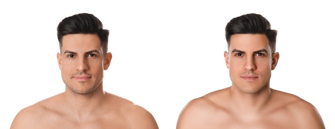 Collage with photos of handsome man before and after shaving on white background. Banner design 