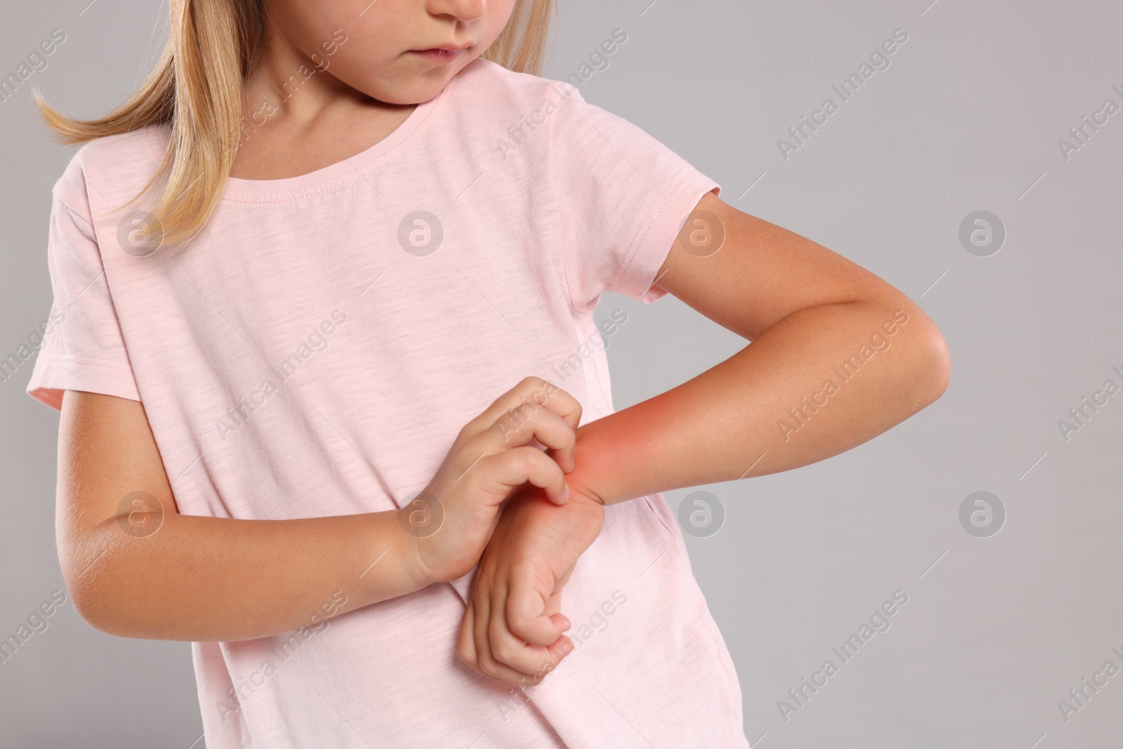 Photo of Suffering from allergy. Little girl scratching her hand on light gray background, closeup