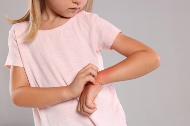 Suffering from allergy. Little girl scratching her hand on light gray background, closeup