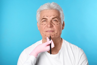 Photo of Doctor drawing marks on man's face for cosmetic surgery operation against blue background