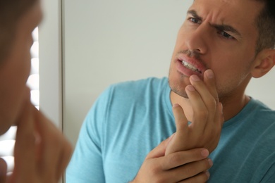 Photo of Man with herpes touching lips in front of mirror at home