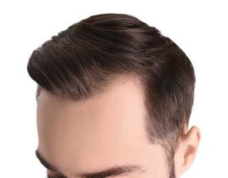 Young man with hair loss problem on white background, closeup