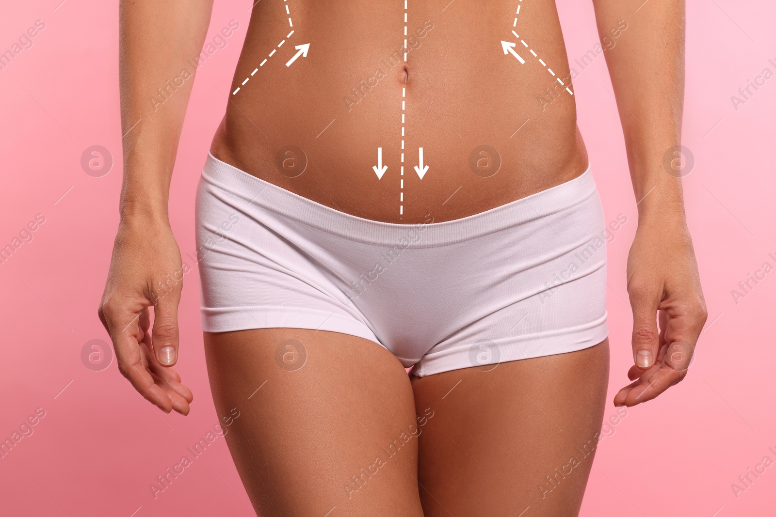 Image of Woman with markings for cosmetic surgery on her abdomen against pink background, closeup