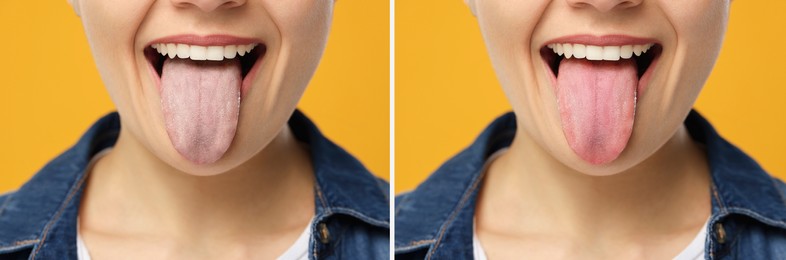 Image of Collage with photos of woman before and after tongue cleaning on yellow background, closeup
