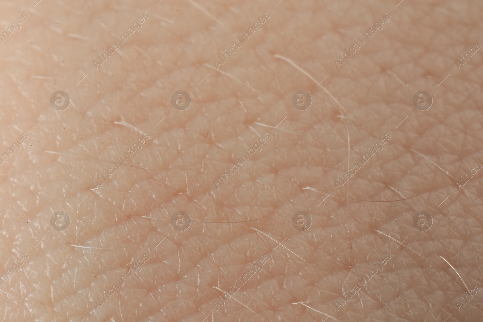 Photo of Texture of dry skin as background, macro view