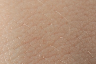 Photo of Texture of dry skin as background, macro view