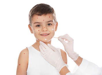 Photo of Doctor applying cream onto skin of little boy with chickenpox on white background. Varicella zoster virus