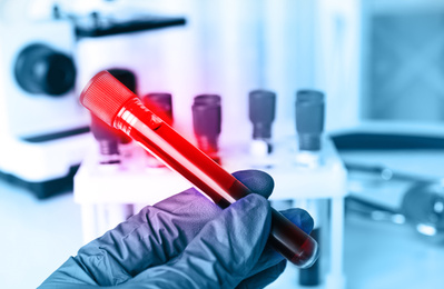 Image of Scientist holding test tube with blood sample, closeup. Laboratory analysis