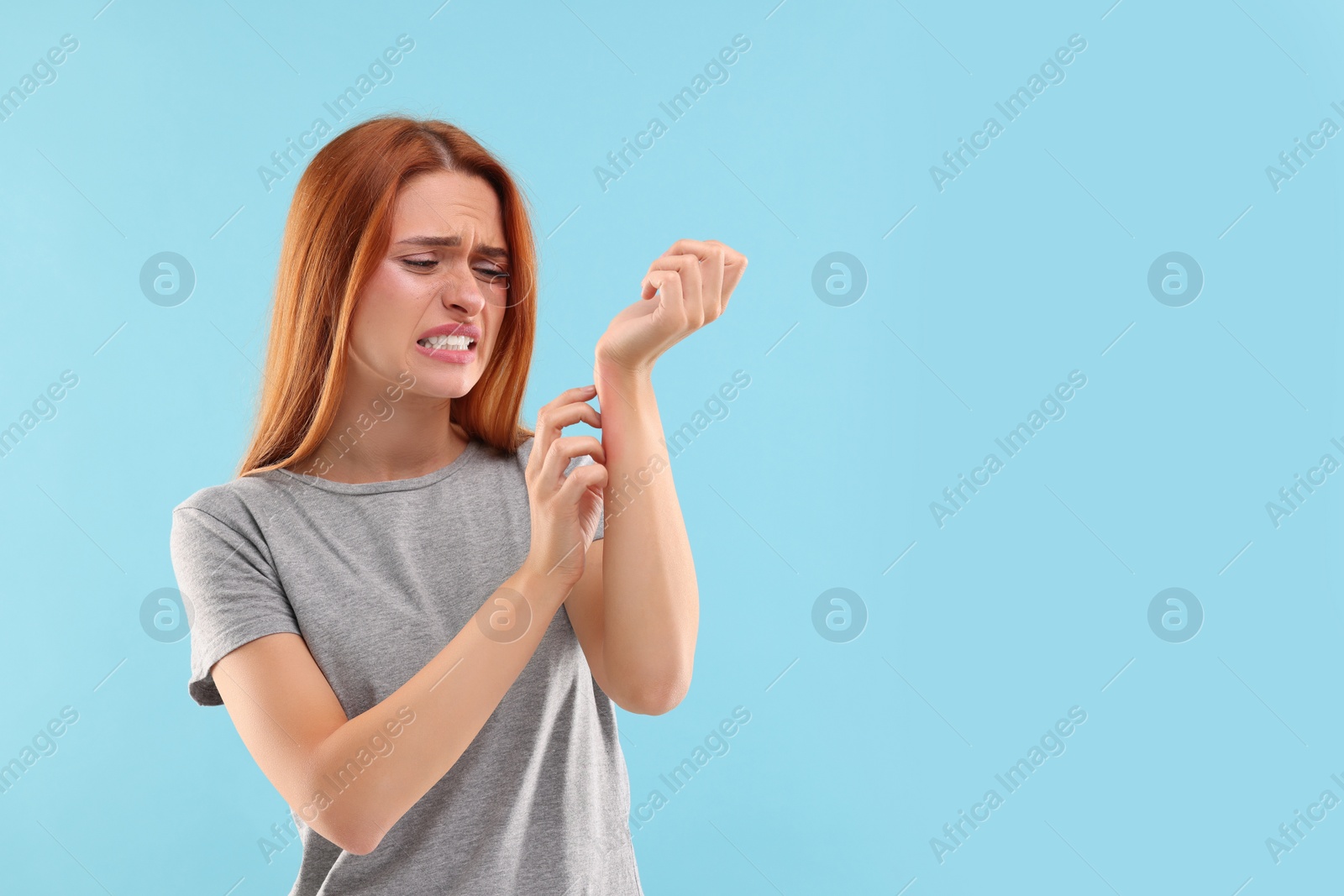 Photo of Suffering from allergy. Young woman scratching her arm on light blue background, space for text