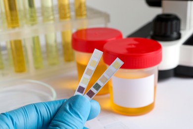 Photo of Nurse holding test strips at table, closeup. Urine analysis