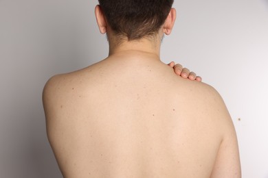 Closeup of man's body with birthmarks on light grey background, back view
