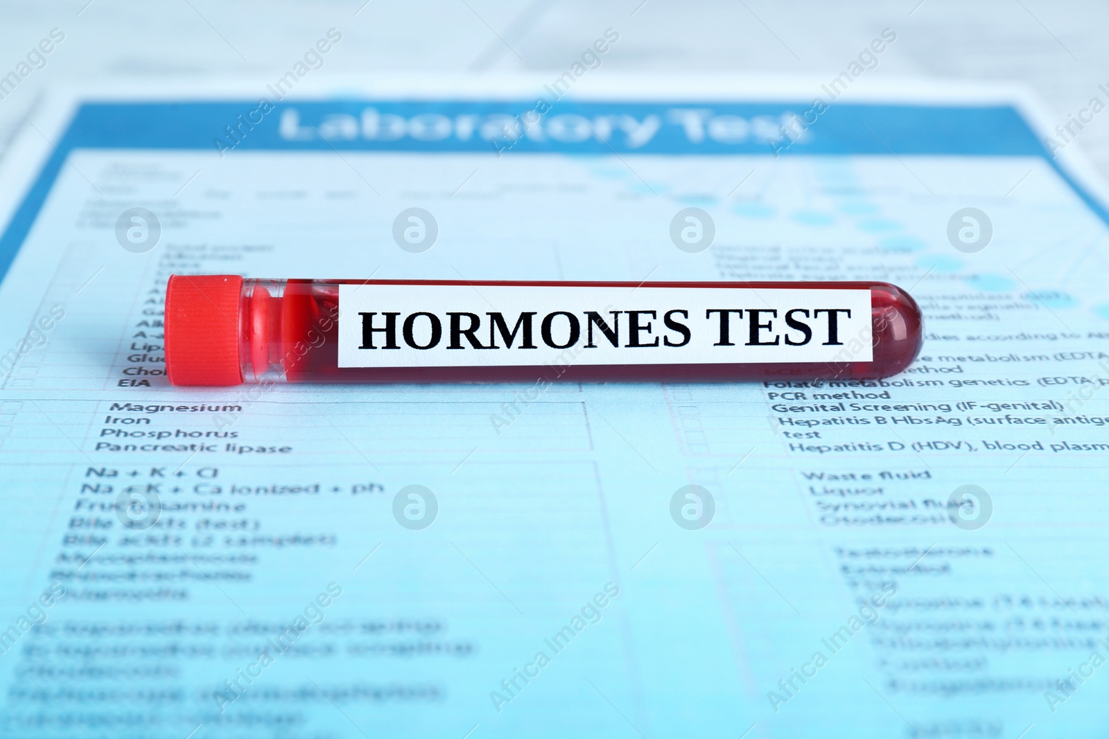 Photo of Hormones test. Sample tube with blood on laboratory form