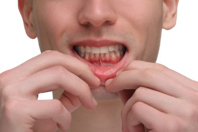Photo of Man showing his clean teeth on white background, closeup