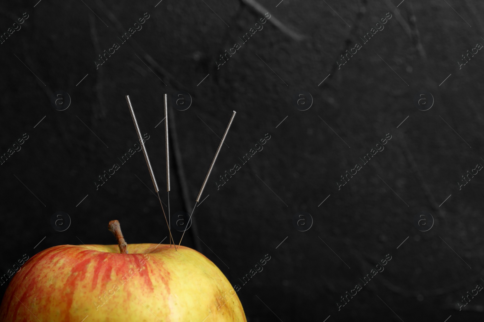 Photo of Needles for acupuncture and apple on dark background