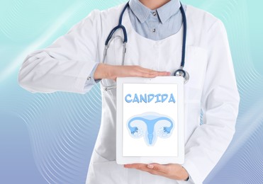 Image of Doctor holding modern tablet with word Candida and illustration of female reproductive system on light blue background, closeup