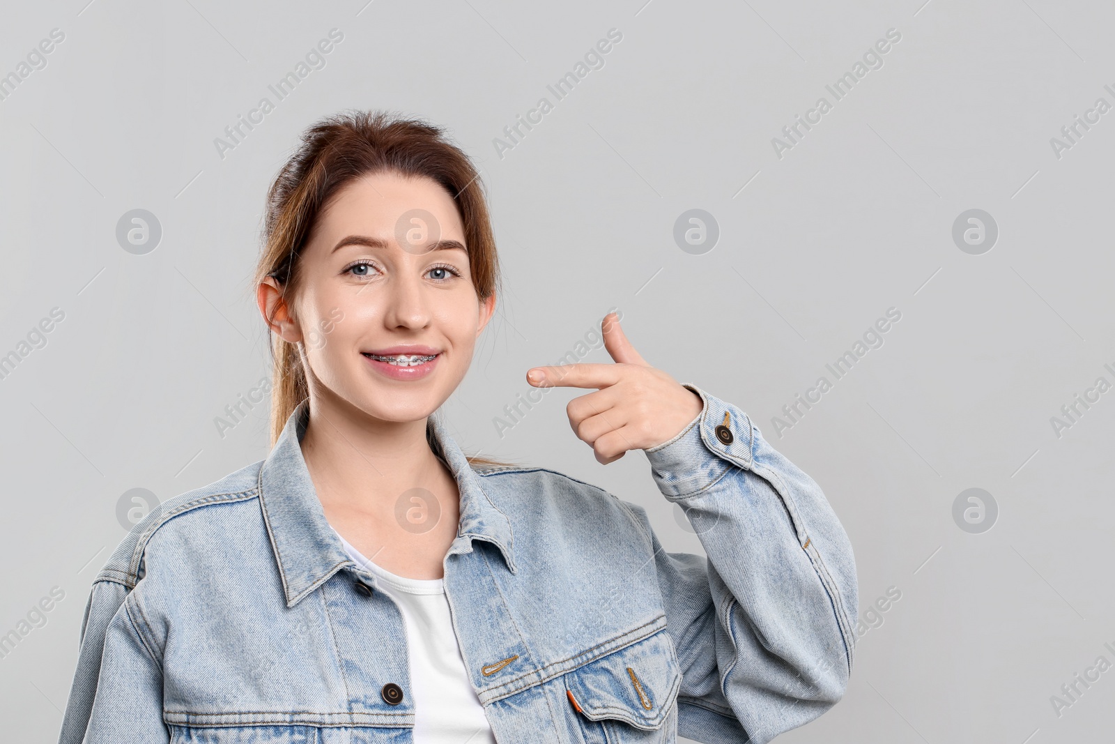 Photo of Portrait of smiling woman pointing at her dental braces on grey background