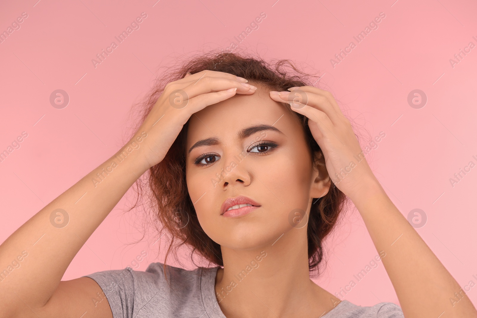 Photo of Beautiful young woman with acne problem on color background
