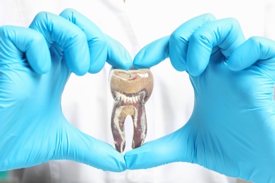 Photo of Dentist holding educational model of tooth, closeup view