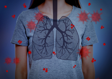 Image of Woman with diseased lungs on blue background